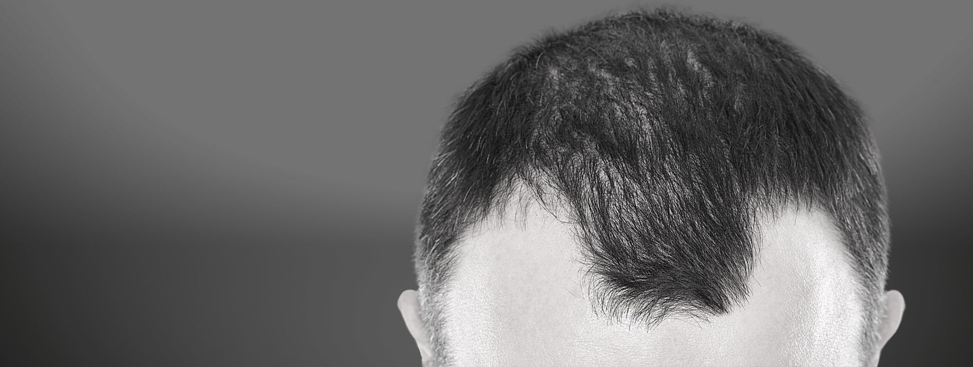 Geheimratsecken und Tonsur clever verstecken