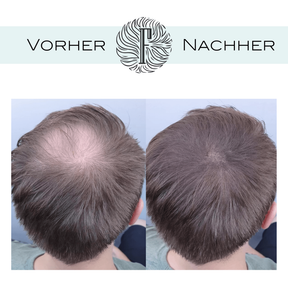 Fidentia Haar Shader 120 Einheiten Karton