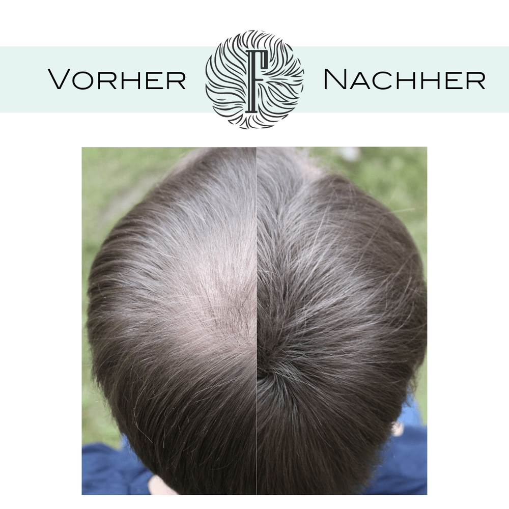 Fidentia Premium Schütthaar 28g