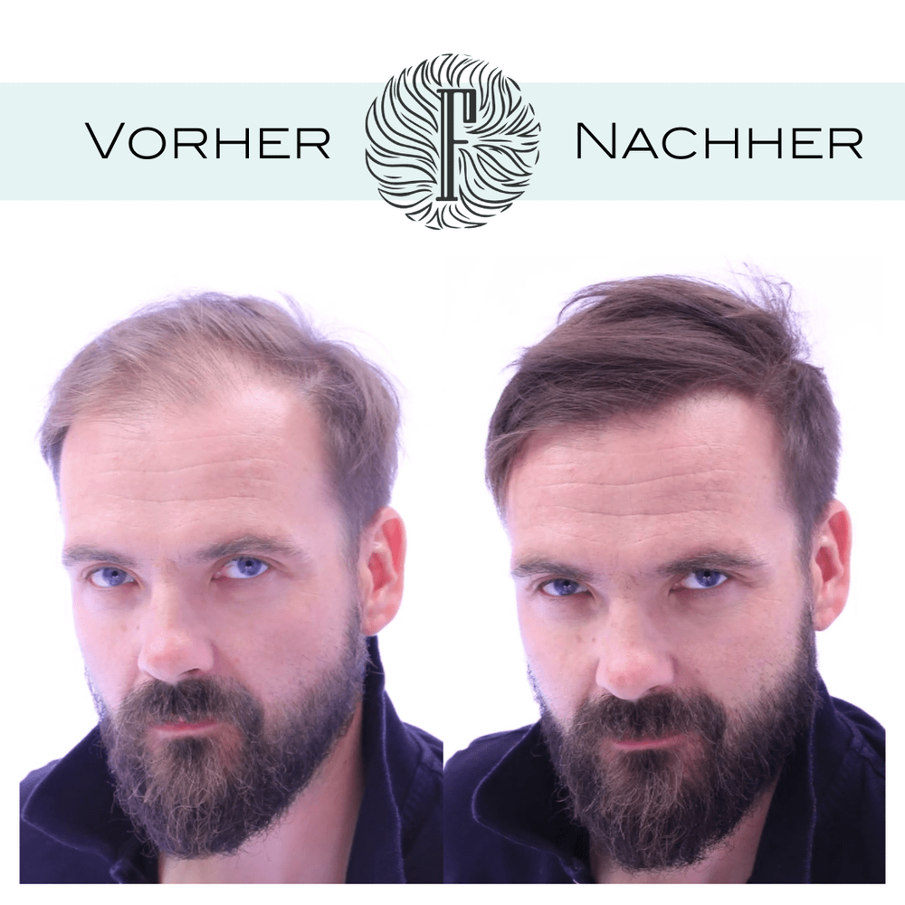 Mane Haarauffüller Haarverdichter Spray zur Haarverdichtung 100ml