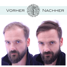 Mane Haarauffüller Haarverdichter Spray zur Haarverdichtung 100ml